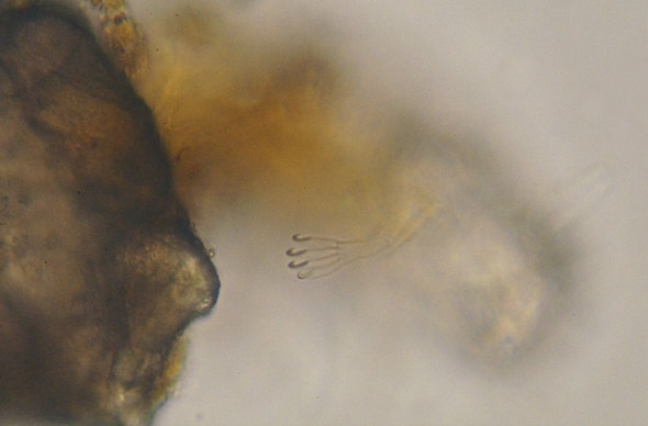 [ Meeresbärtierchen: Aufnahme mit dem trinokularen Mikroskop BTC BIM135T ]