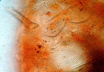 tardigrades tardigrada detail cornechiniscus