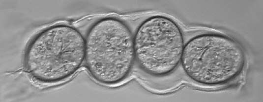 [ Tardigrades: Eggs deposited by Milnesium tardigradum ]