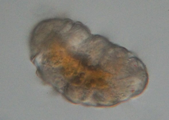 [ Small tardigrade from the Austrian rock wall ]