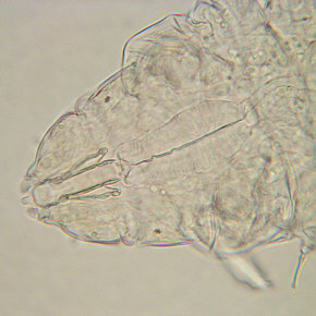 [Milnesium tardigradum, 1. Tag]