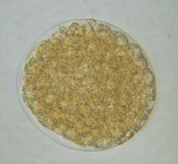[ Echiniscus tardigrade egg, multi cell stage. 'Morula' ]