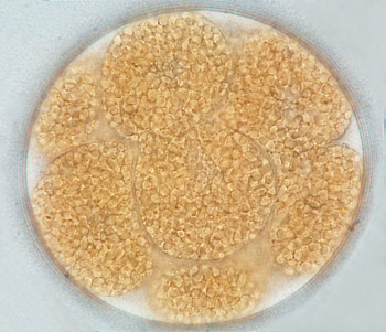 [ Echiniscus tardigrade egg, eight cell stage ]