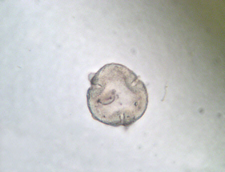 [ Pollen grain from the "Grimmia pulvinata" sample ]