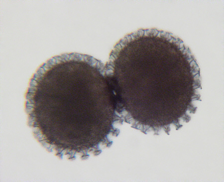[ tardigrade eggs as seen under the microscope ]