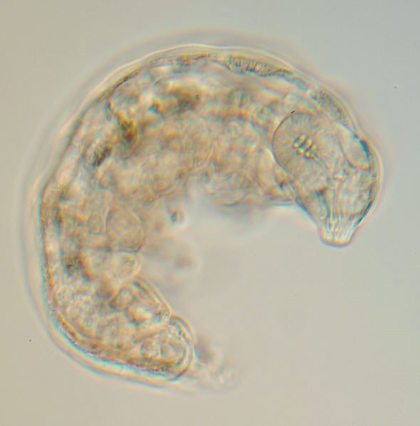 [ Tardigrade from a Giant Redwood, total view ]