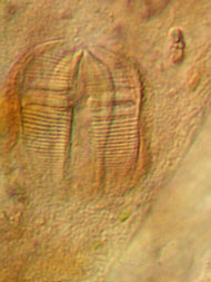 [ Tardigrade stomach: remains of rotifer pharynx) ]