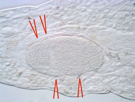 [ tardigrade, egg cell ]