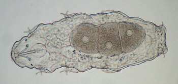 [ tardigrade with eggs ]