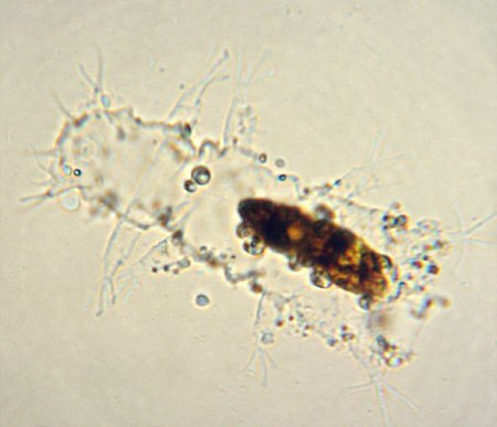 [ Baltic Sea tardigrade cuticula, deposited after moulting ]