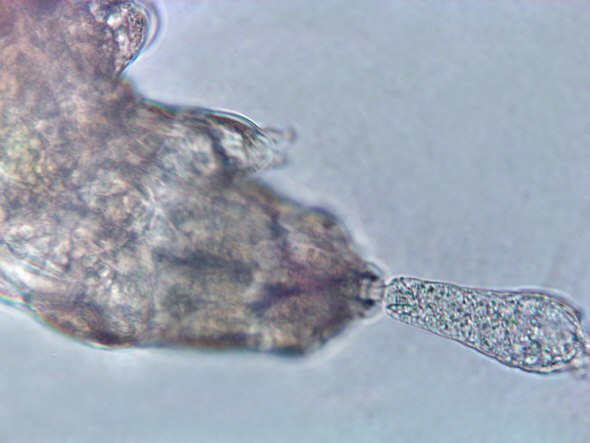 [ Macrobiotus sp. tardigrade with a rotifer partially sucked empty ]