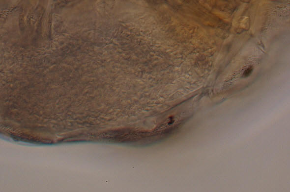 [ Typical tardigrade from Munich city pavement moss: male]