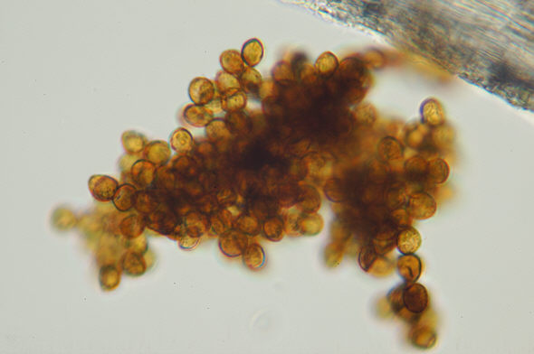 [ Spores of Grimmia pulvinata ]