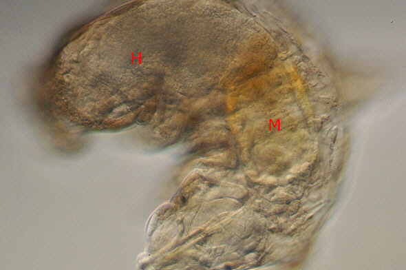 [ A tardigrade from Munich pavement moss: anatomical detail ] 