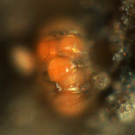 [tardigrades #8: red 'Echiniscus' eggs -- 'Echiniscus'-Gelege ]