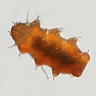 [tardigrades #9: red 'Echiniscus' water bear - roter Echinisce]