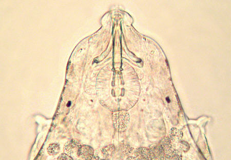 [ tardigrade male: the head]